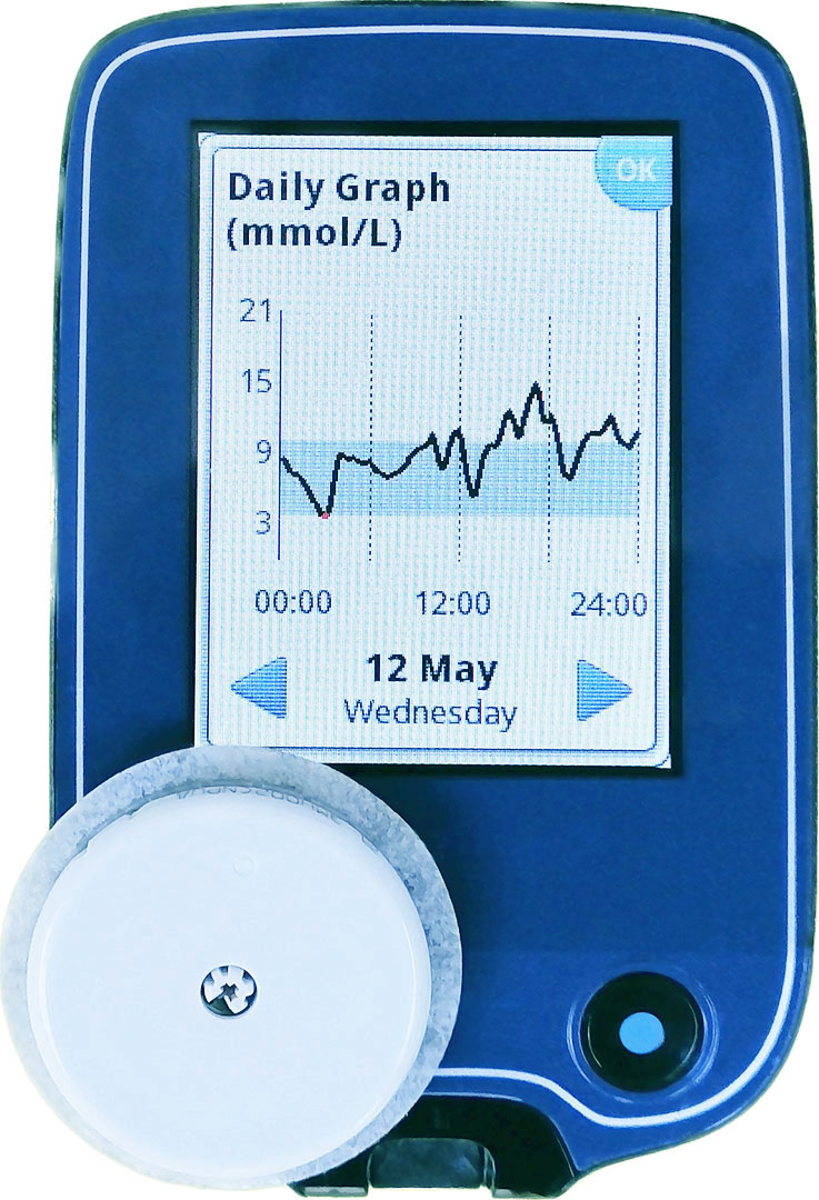 Patient and CGM